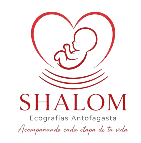 SHALOM